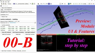 3D Slicer Lamina Landmark Labeling. #00-B. Preview -- module UI  & features