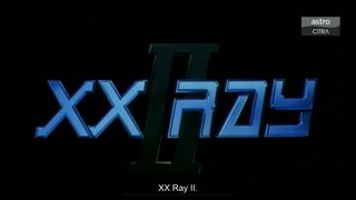 XX Ray II 1995