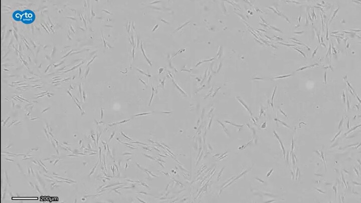 Time-lapse video of primary corneal keratocytes with a fibroblastic phenotype