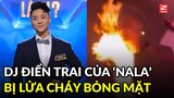 DJ Wukong “Người ấy là ai” gặp tai nạn lúc biểu diễn, bị lửa cháy bỏng mặt