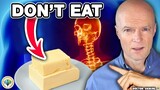 Top 10 Foods That DESTROY Your HEALTH