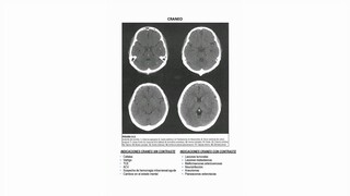 Indicaciones del cráneo