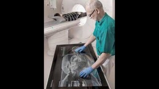 Radiología forense