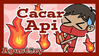Agustory Eps. 14 | Cacar Api | Animasi Pengalaman