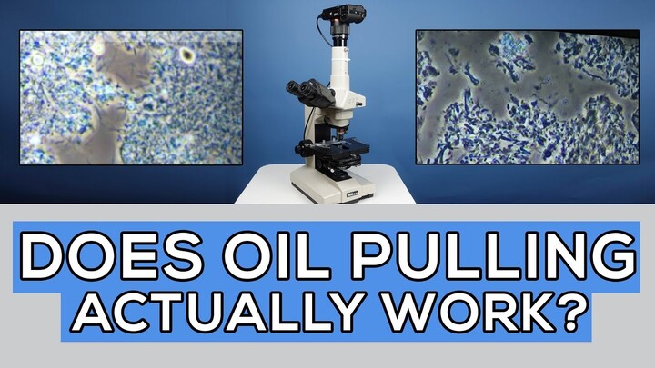 Oil Pulling for 35 Days: Did It Cure Gum Disease? Microscope Analysis🔬