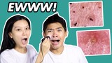 EWW! OUR FACE UNDER A MICROSCOPE (OILY SKIN) 😱| SOME BY MI MIRACLE ACNE CLEAR FOAM REVIEW | WE DUET
