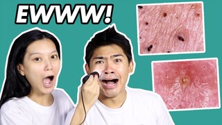 EWW! OUR FACE UNDER A MICROSCOPE (OILY SKIN) 😱| SOME BY MI MIRACLE ACNE CLEAR FOAM REVIEW | WE DUET