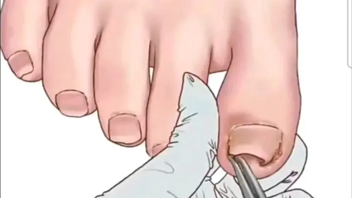 Anime|Pressure-relief|Have a Pedicure Today
