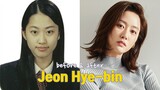 Jeon Hye-bin before and after