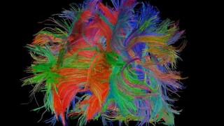 Human Brain Connectivity (DTI) - 4 year old male