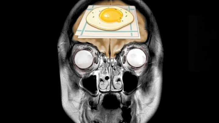 一位已逝美国NBA篮球巨星吃下了提瓦特煎蛋，这是他大脑发生的变化