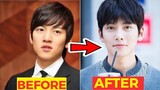 20 Korean Celebs Who Have Undergone Cosmetic Surgery