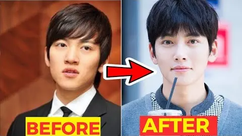 lee jong suk plastic surgery