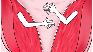Menstrual period + stretch marks