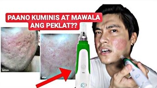 PAANO KUMINIS?! | PAANO MAWALA ANG MGA PEKLAT | DERMAPEN EXPERIENCE | 2020 REVIEW