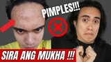 6 MISTAKES Na Ginawa Ko Kaya NASIRA Ang Mukha Ko | Sobrang Daming TIGYAWAT!