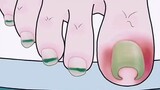 [Anime] Chăm sóc móng chân