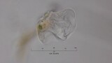 Pond Life Through the Microscope: Amoeba; Amoebae 9 Time Lapse