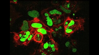 HeLa cells going through mitosis - 96 hour time lapse - Gemcitabine treatment