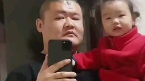 Dad is worried his daughter looks too much like him