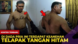 🔴 1365- NGERI !!!! TELAPAK GHAIB HITAM DIDADA PRIA INI