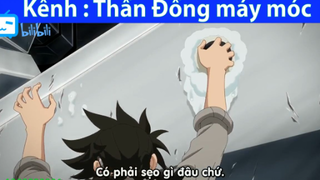 Khi ông thần đồng bị gái chêu cho xấu hổ vì cái xẹo ở mông #anime