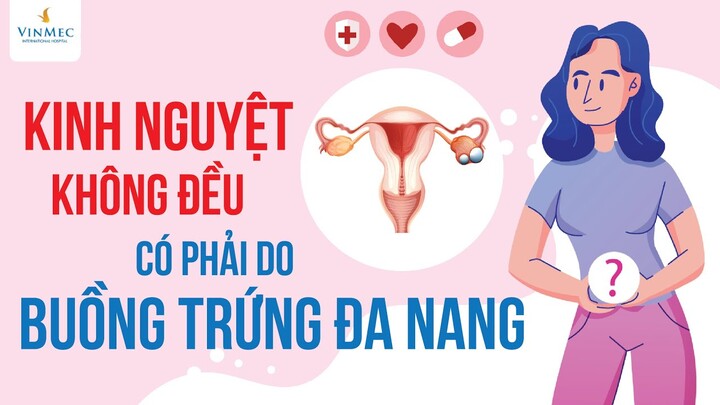 Kinh nguyệt không đều có phải do buồng trứng đa nang|ThS. BS Nguyễn Thị Tâm Lý, BV Vinmec Times City