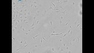 Teaching cell biology with live-cell imaging: contamination in a HeLa cell culture | CytoSMART Lux2